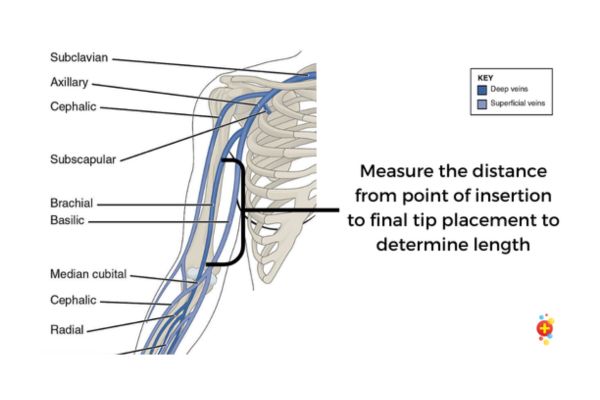 Paediatric Midline Catheter toolkit